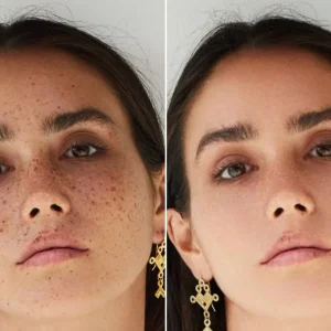 Photo Spot Cleanup and Image Imperfection Removal